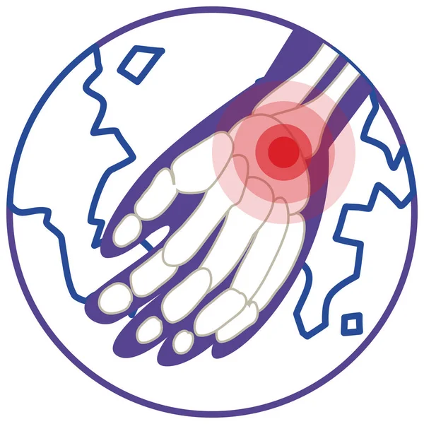 Hand Joint Pain Injury Illustration — Stockový vektor