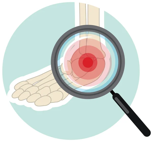 Arm Joint Pain Injury Illustration — стоковый вектор