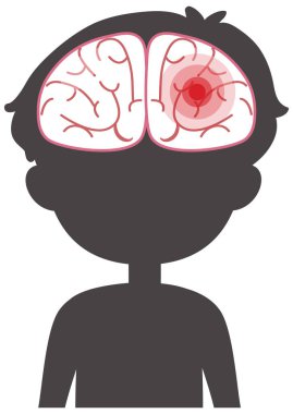 Beyni olan vücut siluetinde kırmızı sinyal çizimi var.