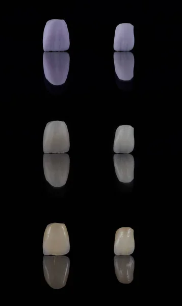 Två tandkeramiska kronor i överkäken efter fräsning, sintring och efter målning. Estetisk tandvård. — Stockfoto