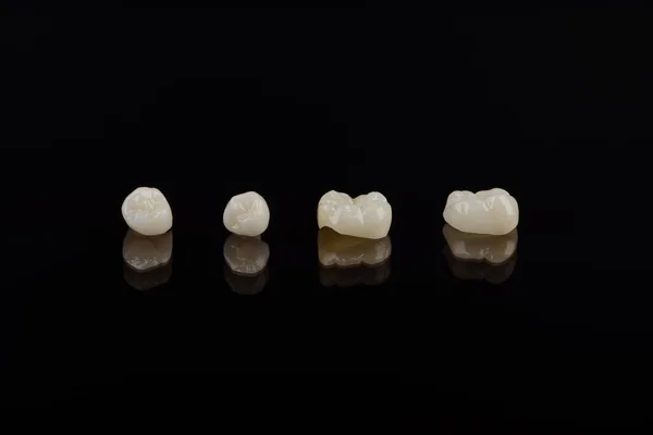 Qualified anatomic ceramic and zirconia crowns of human teeth close up macro isolated on black background. — Stock Photo, Image