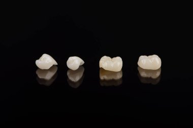 Nitelikli anatomik seramik ve zirkon insan dişlerinden taçlar siyah arkaplanda izole edilmiş makroyu kapatın.