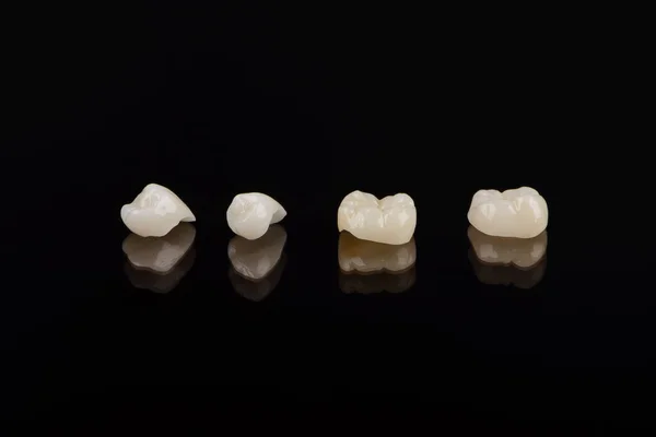 Προσόντα ανατομικά κεραμικά και ζιρκονία κορώνες των ανθρώπινων δοντιών close up μακροεντολή απομονώνονται σε μαύρο φόντο. — Φωτογραφία Αρχείου