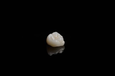 Nitelikli anatomik seramik ve zirkon insan dişlerinden taçlar siyah arkaplanda izole edilmiş makroyu kapatın.