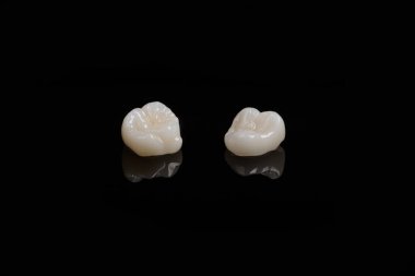 Nitelikli anatomik seramik ve zirkon insan dişlerinden taçlar siyah arkaplanda izole edilmiş makroyu kapatın.