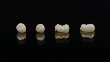 Nitelikli anatomik seramik ve zirkon kaplama insan dişleri siyah arka planda izole edilmiş makroyu kapatın. Estetik dişçilik kavramı.