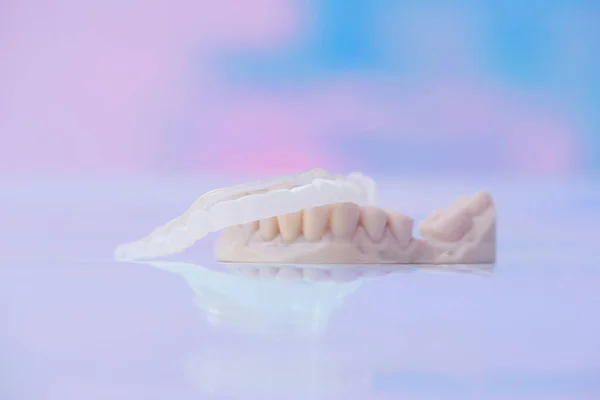 Potištěné Průhledné Zubní Víčko Polymeru Světle Barevném Pozadí Zubní Dlaha — Stock fotografie