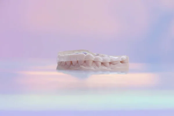 3D printed transparent dental cap made of polymer on a light colorful background. Dental splint against bruxism.
