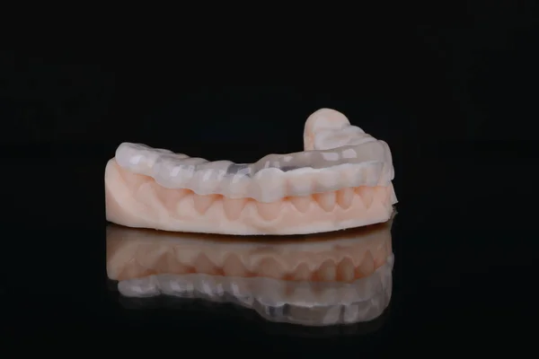 Tapa Dental Transparente Impresa Hecha Polímero Sobre Fondo Negro Aislado —  Fotos de Stock